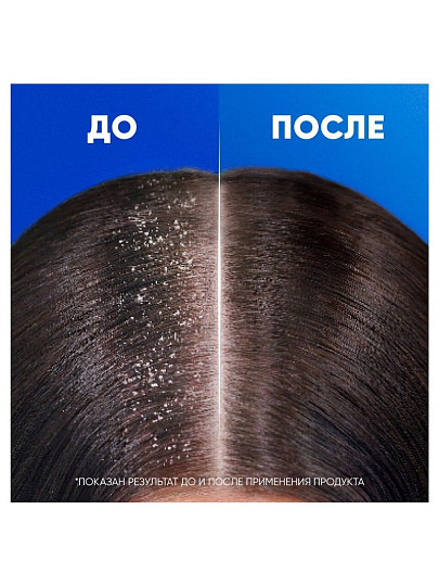 Шампунь Head & Shoulders, Яблочная свежесть, против перхоти, 360 мл