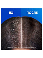Шампунь Head &amp;amp; Shoulders, Объем от самых корней, против перхоти, 360 мл - фото 5