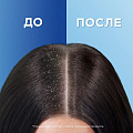 Шампунь Head &amp;amp; Shoulders, Цитрусовая свежесть 2в1, против перхоти, 400 мл - фото 4