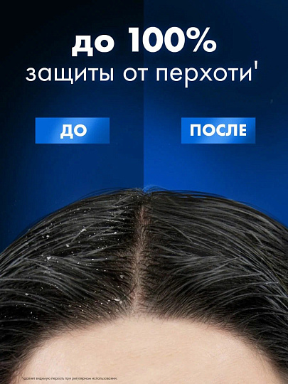 Шампунь Clear vita ABE, Men Энергия свежести, для всех типов волос, для мужчин, 400 мл