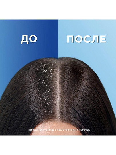 Шампунь Head &amp; Shoulders, Цитрусовая свежесть, для всех типов волос, 400 мл